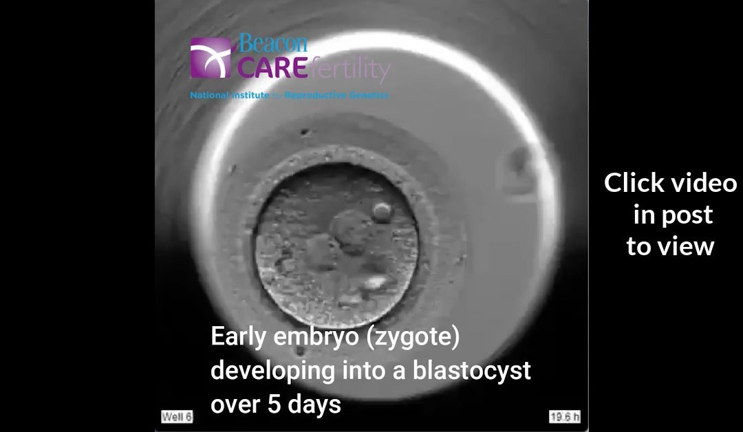 Video-Early Embryo (zygote) developing into a blastocyst over 5 days / CAREmaps timelapse technology