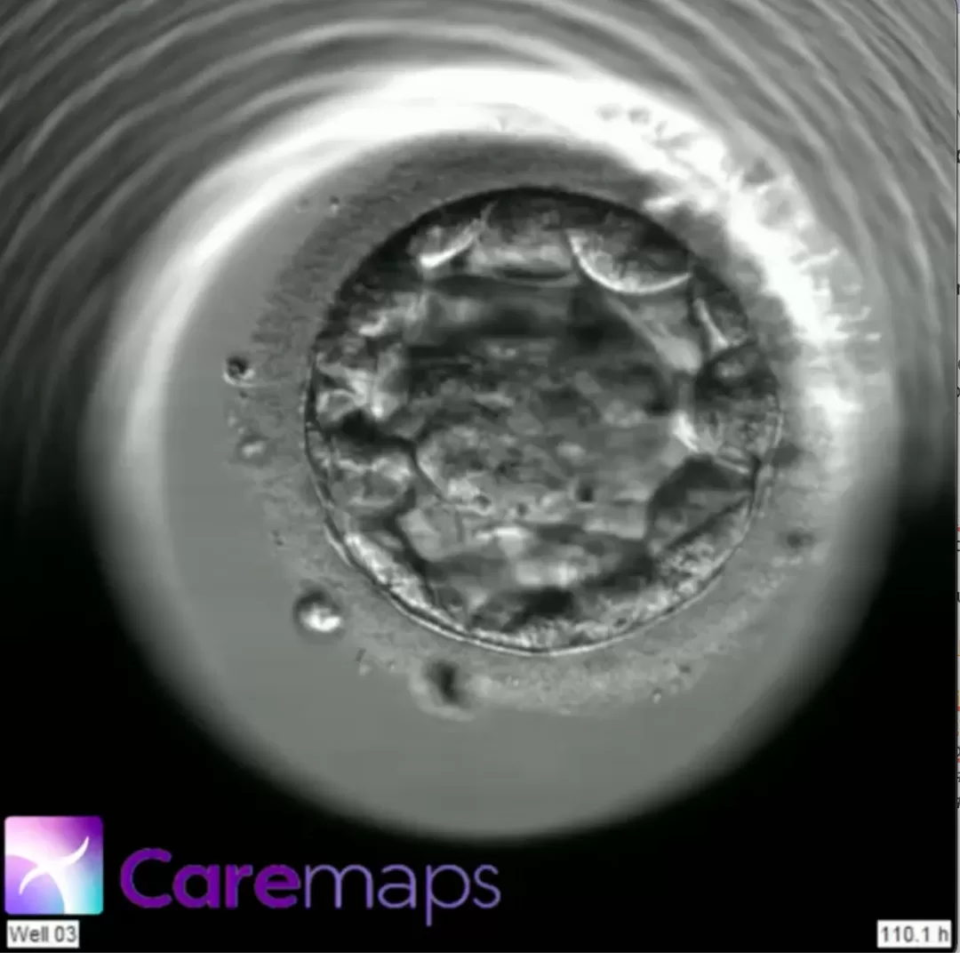 Photo of an embryo with CAREmaps logo
