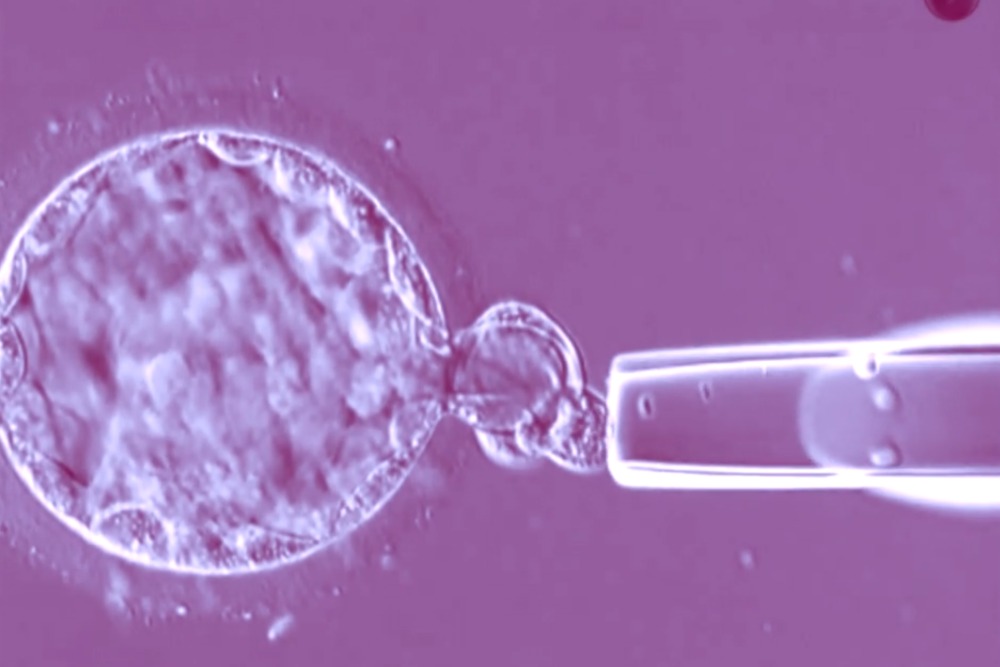Embryo biopsy